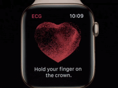ECG Apple Watch 4